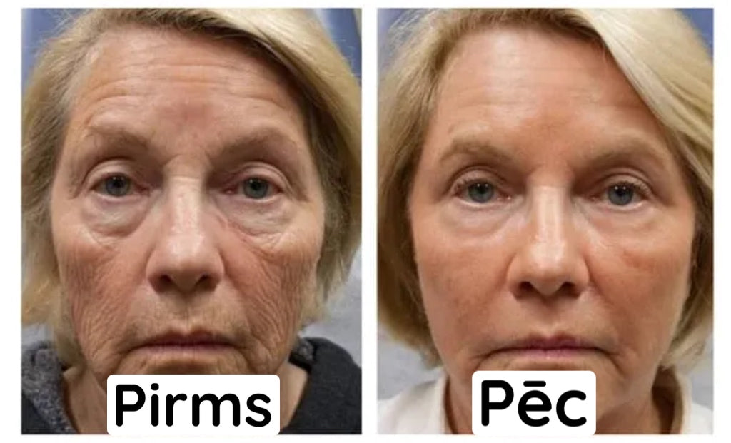BOTOX SEJAS SERUMS