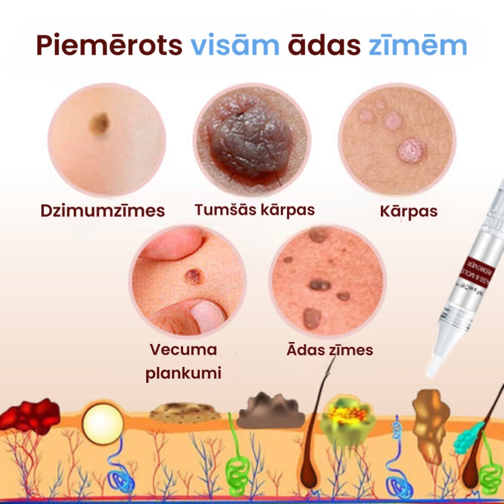 “WipeOff™” dzimumzīmju un ādas plankumu noņemšanas ziede