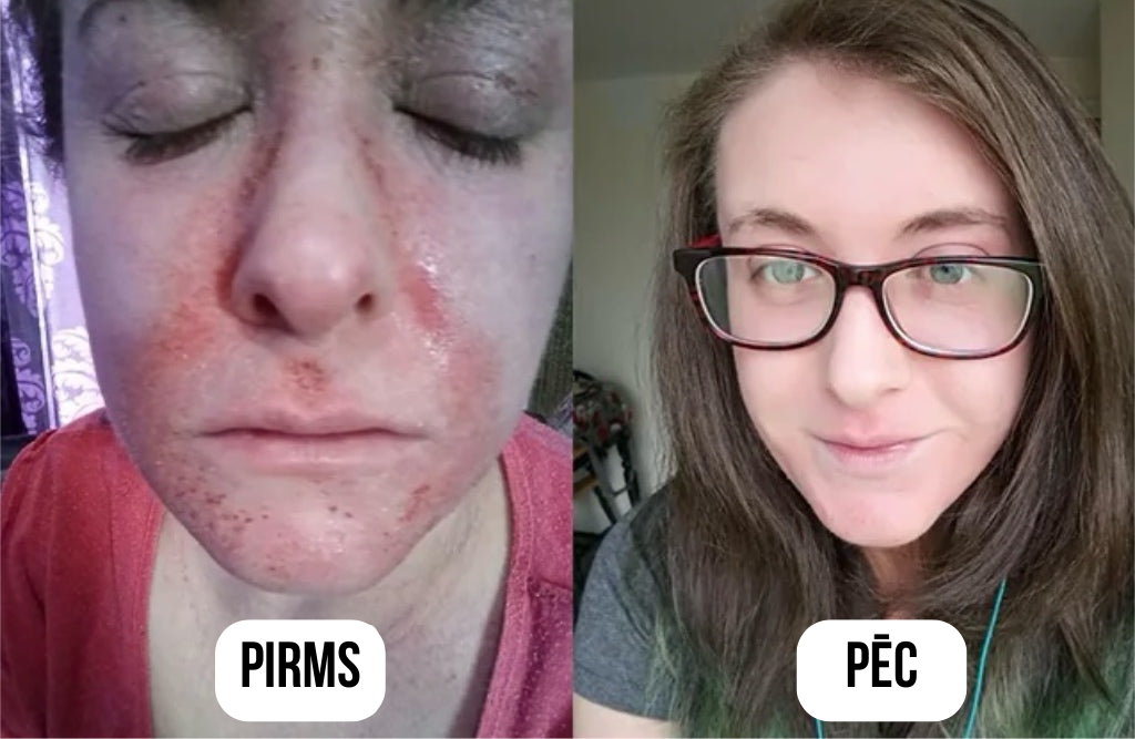 Serums visām ādas problēmām