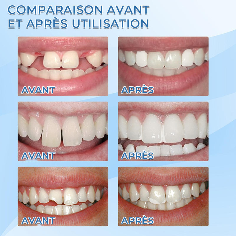 Pagaidu zobu implantu materiāls