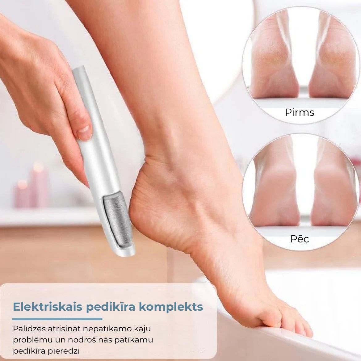 💕 Elektriskais pēdu rumbu noņemšanas aparāts