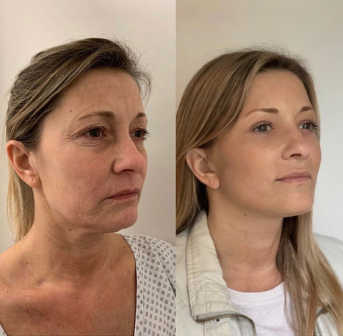 Sejas ādas atjaunošanas serums