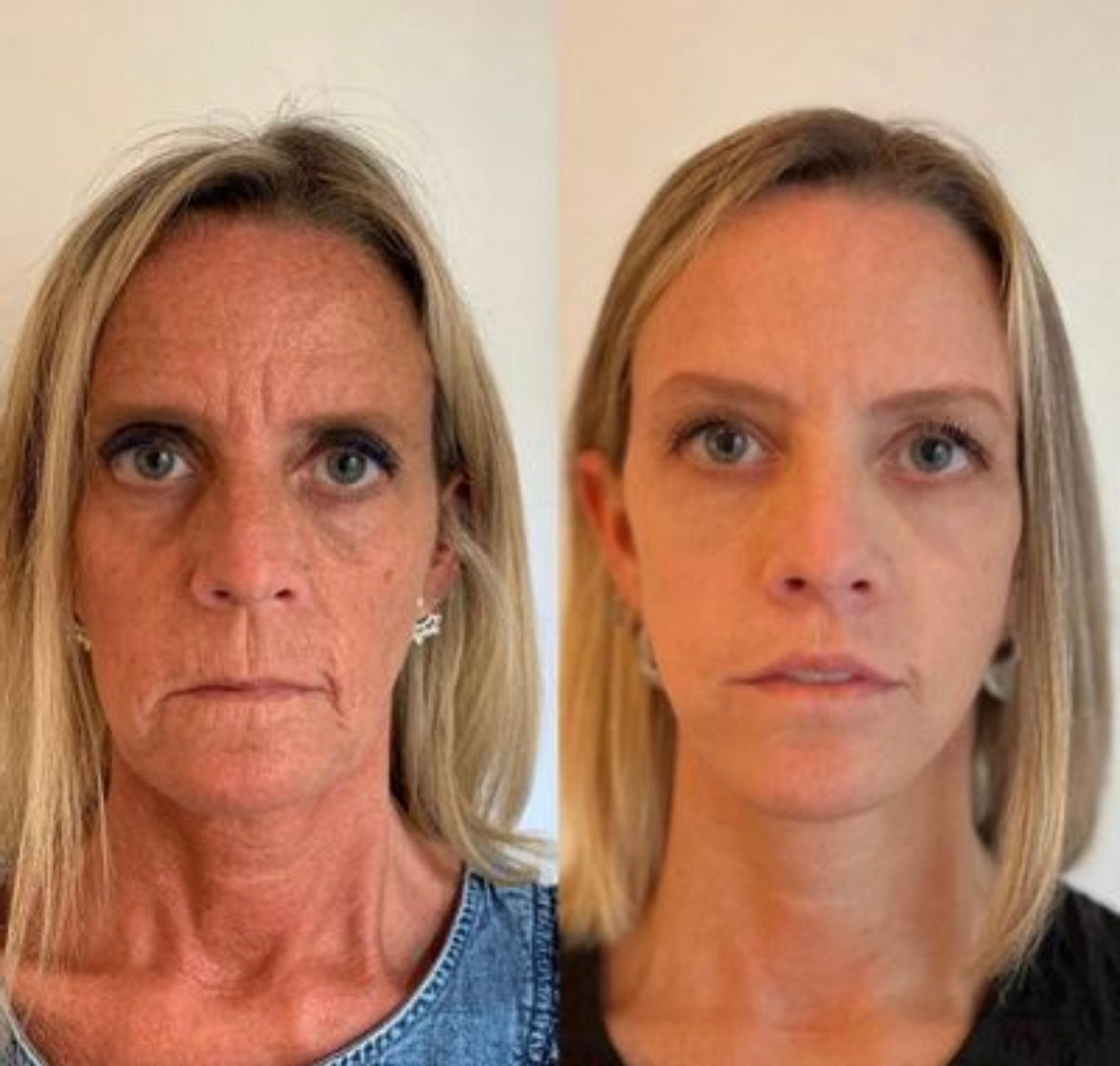 Sejas ādas atjaunošanas serums