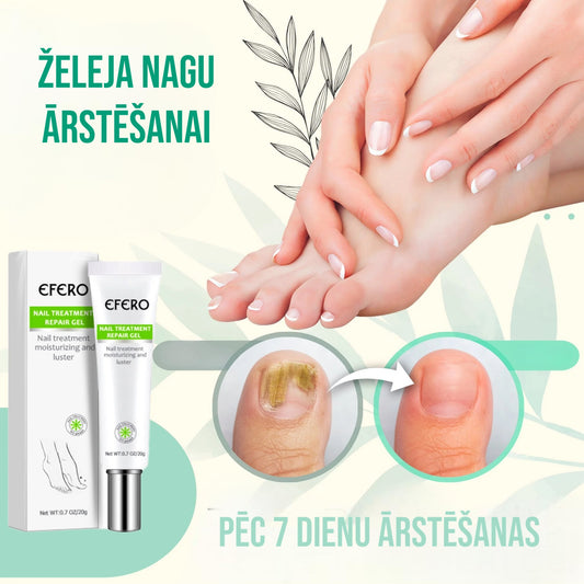 Pretsēnīšu gēls nagiem