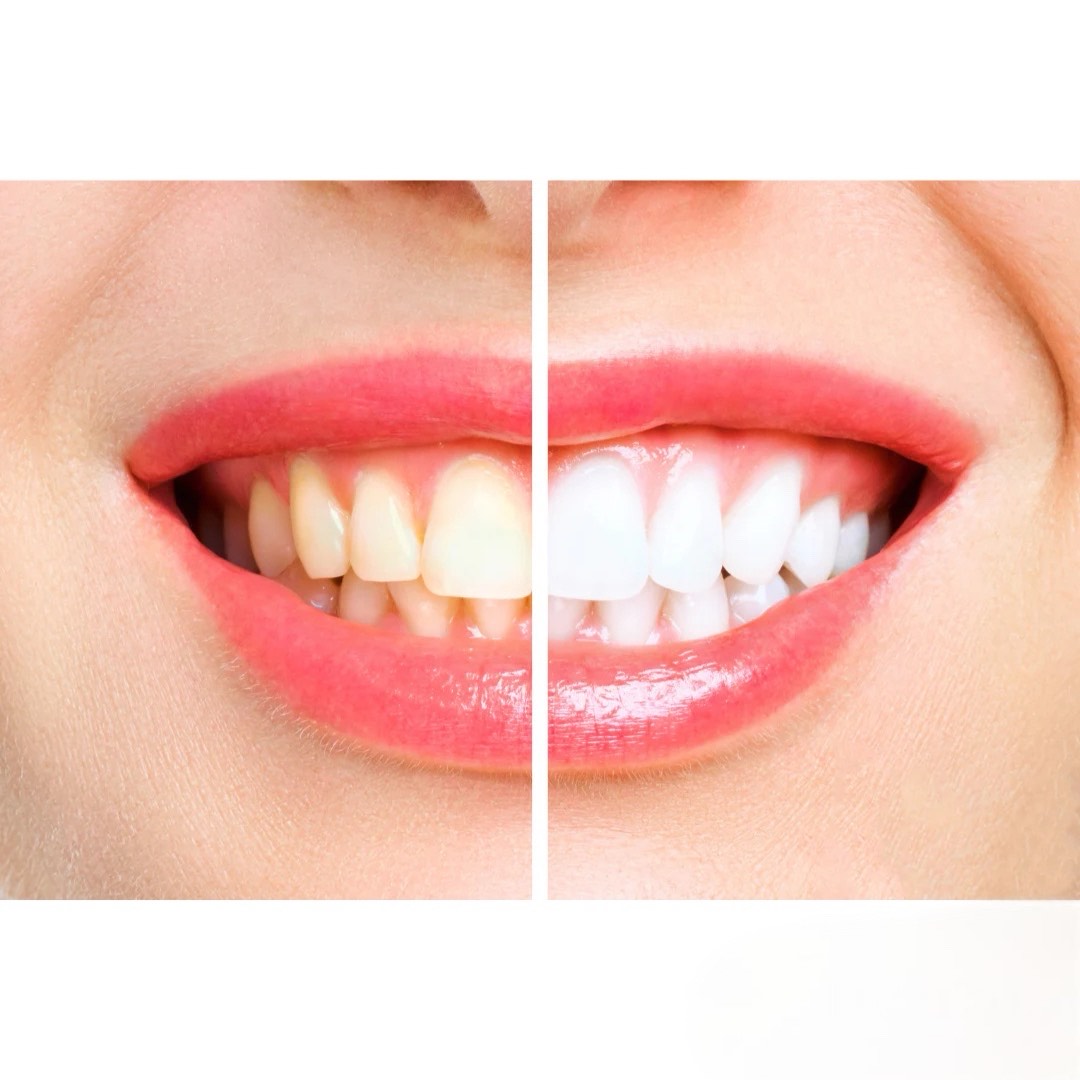 OralTech Pro | Nākotnes tehnoloģijas zobu kopšanai
